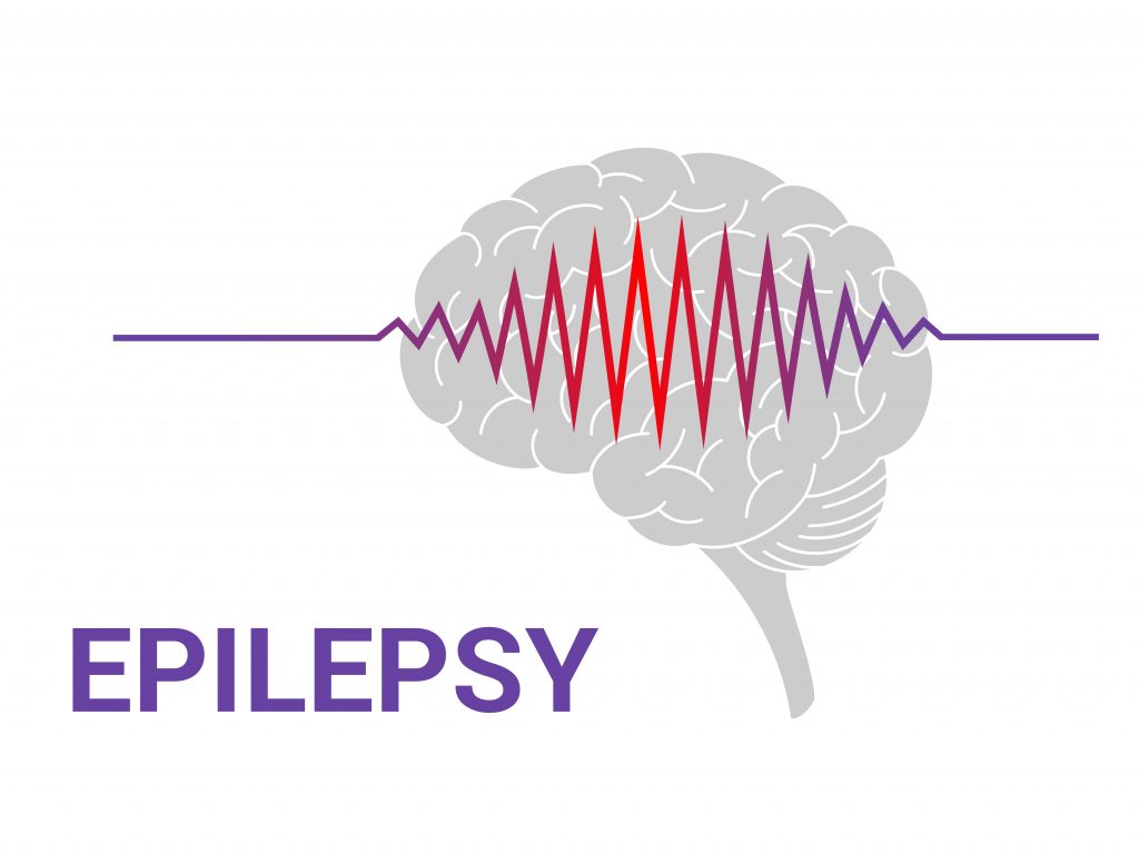 epilepsy sleep monitor